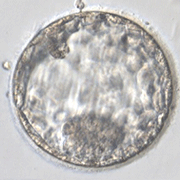 拡張胚盤胞