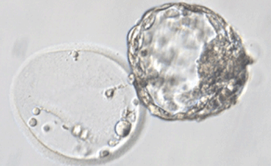 孵化後胚盤胞